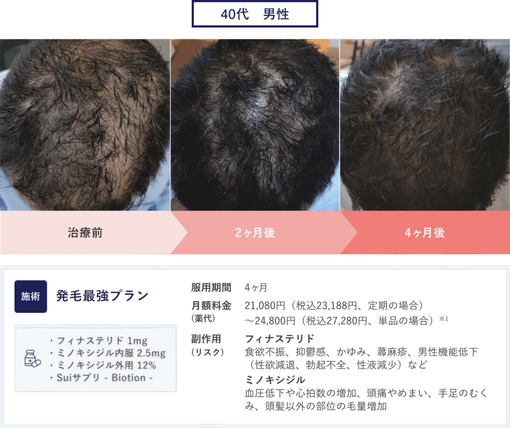 クリニックフォア　症例写真