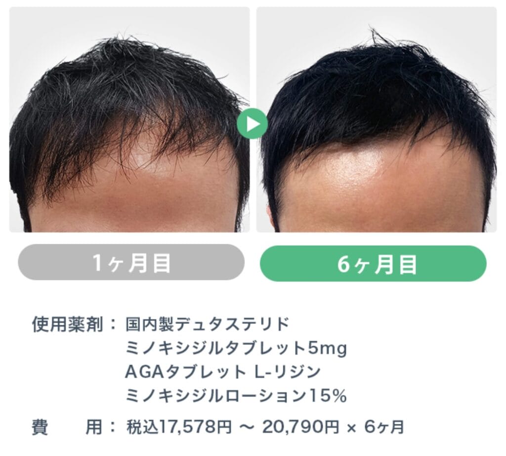 症例2