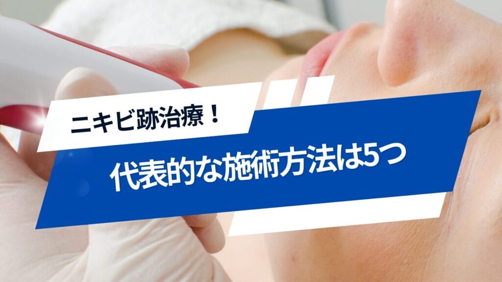 ニキビ跡治療の施術方法で代表的なものは5つ