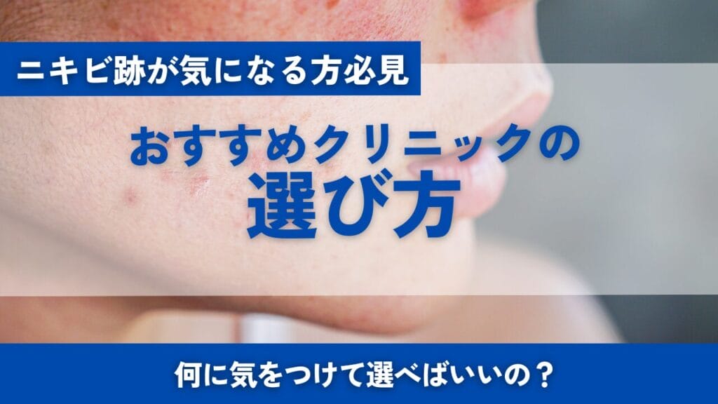 クリニックの選び方