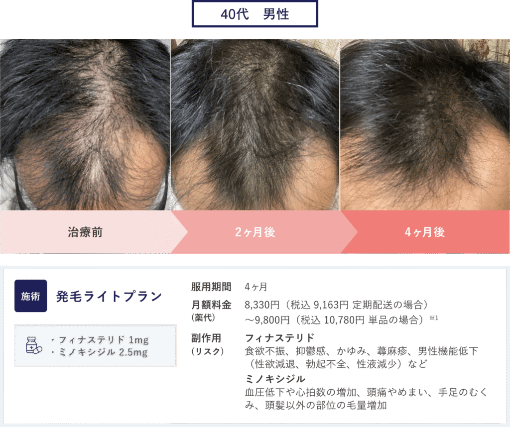 症例1