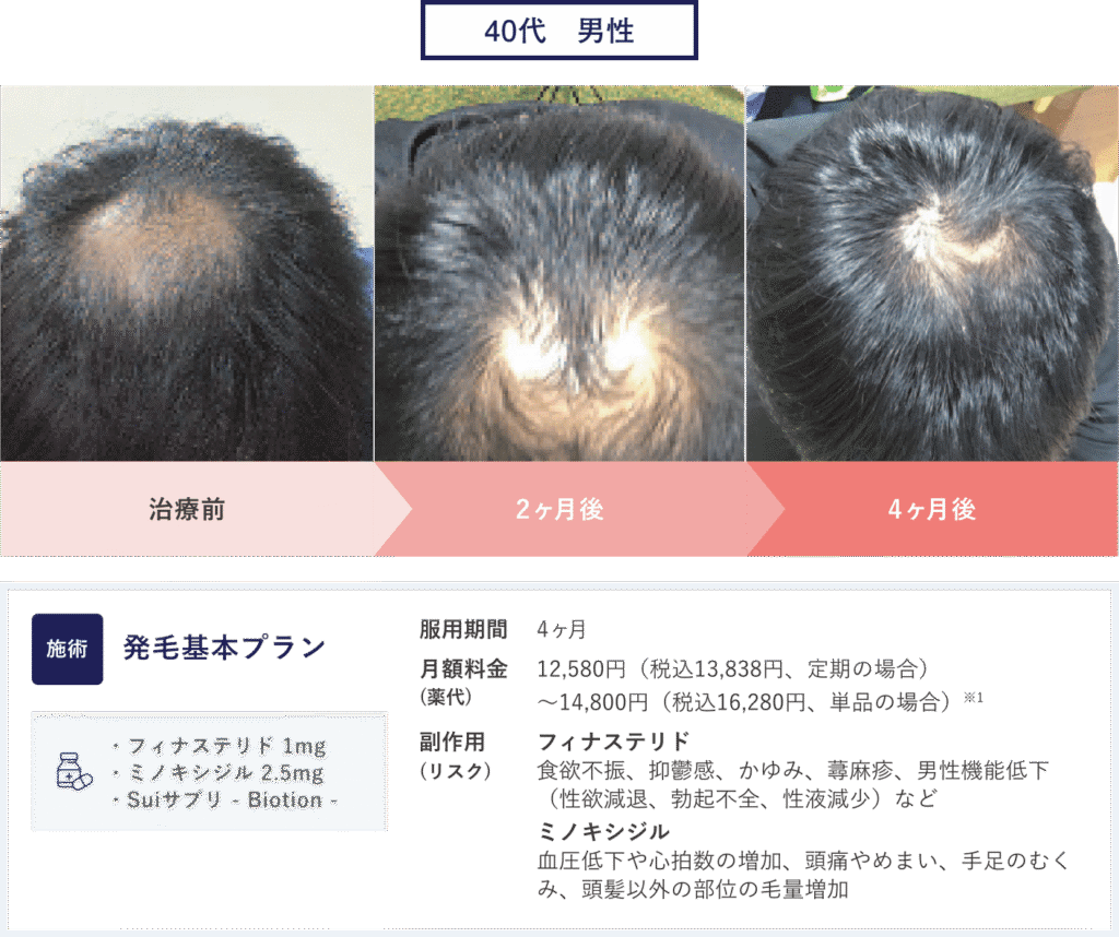 症例2