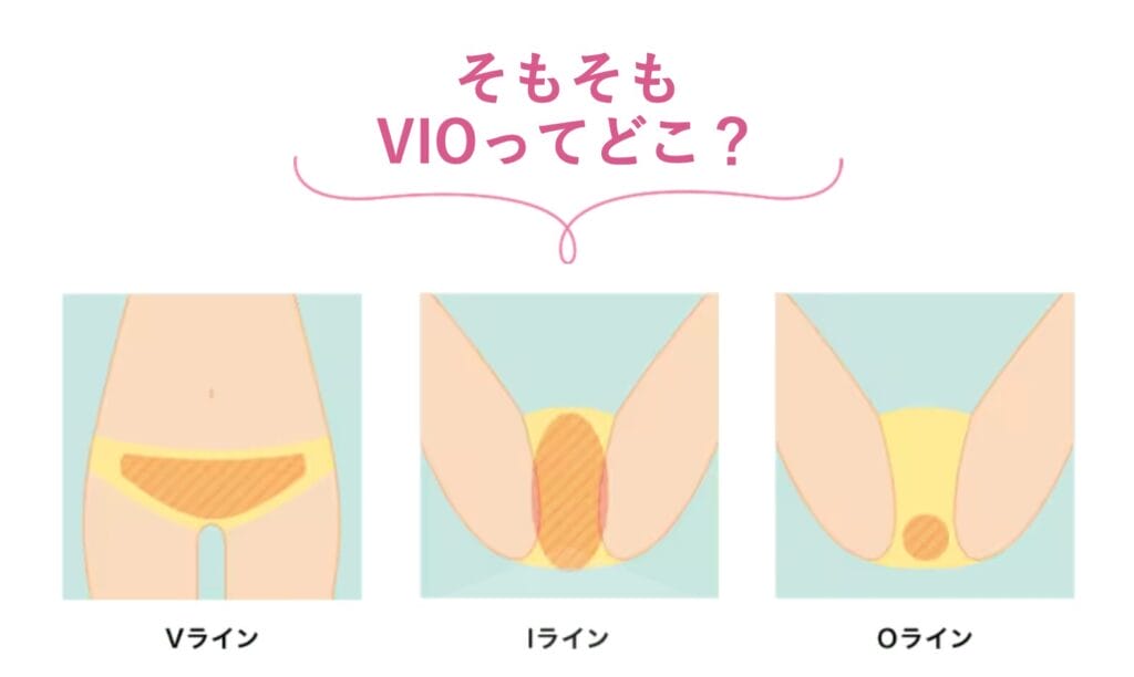 VIOってどこ?