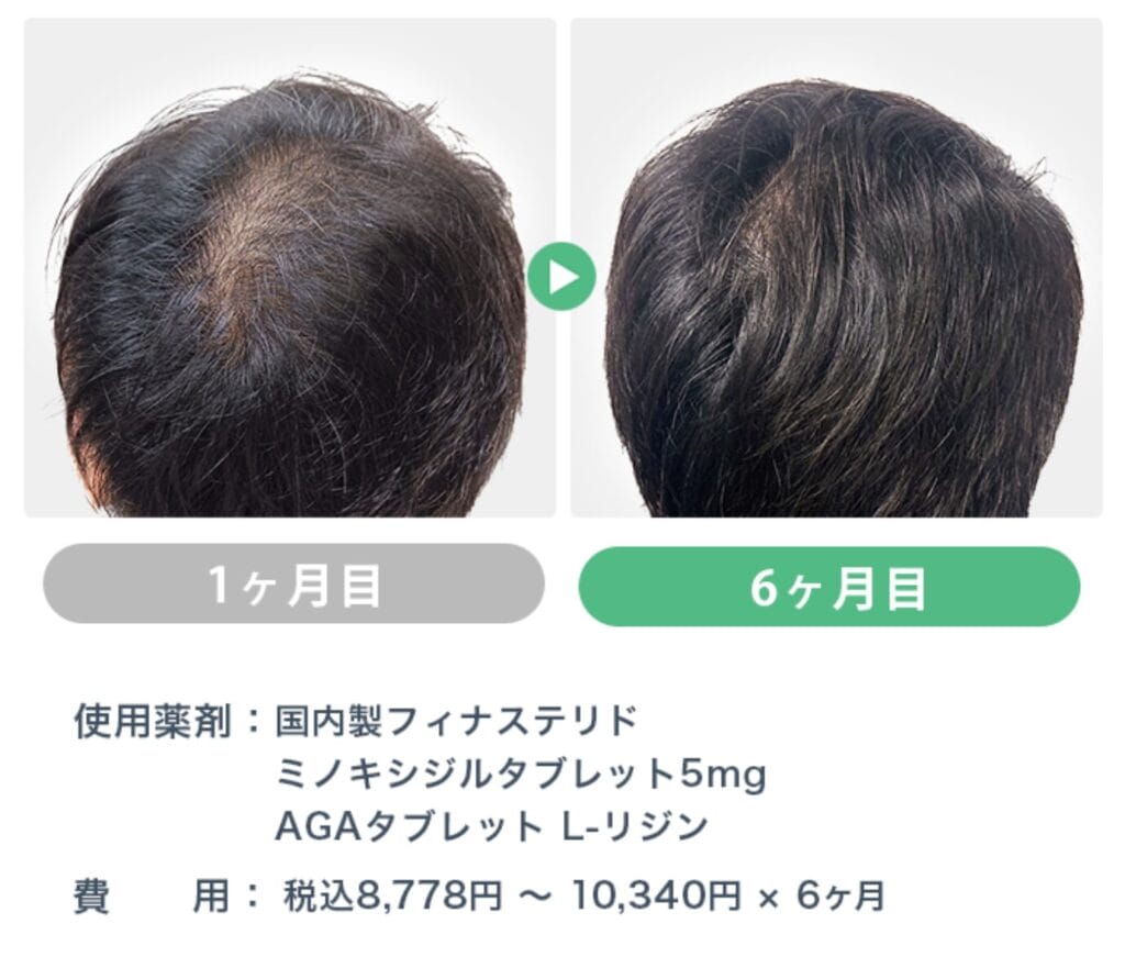 症例1
