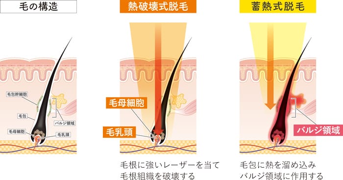 熱破壊式・蓄熱式