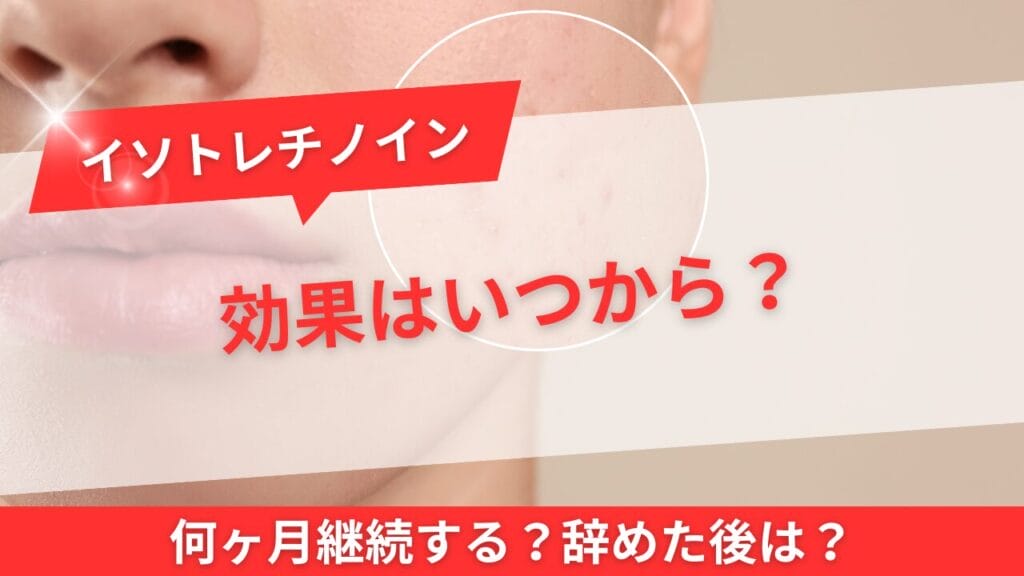 イソトレチノインの効果はいつから?