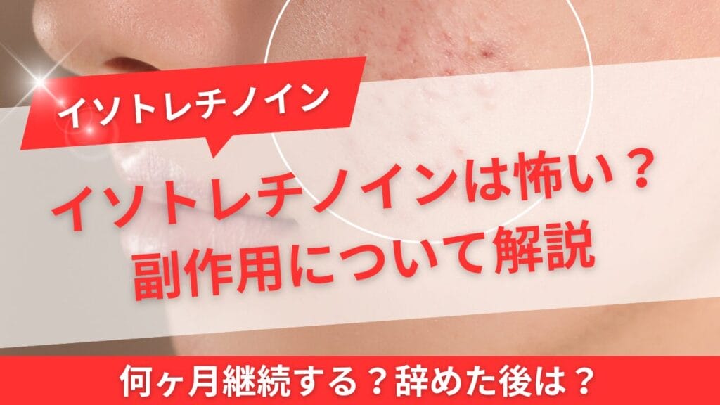 イソトレチノインは怖い?副作用について解説
