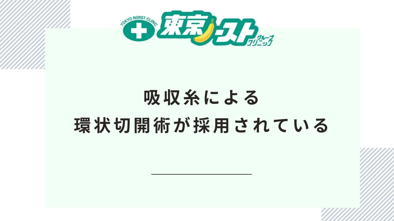 特徴③吸収糸による環状切開術が採用されている